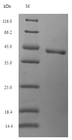 N-glycosylase/DNA lyase (OGG1), human, recombinant