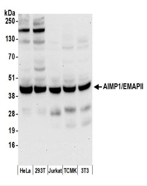 Anti-AIMP1/EMAPII/SCYE1
