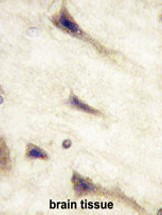 Anti-EphA5, clone 46CT61.6.4