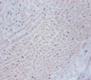 Anti-CSRP2