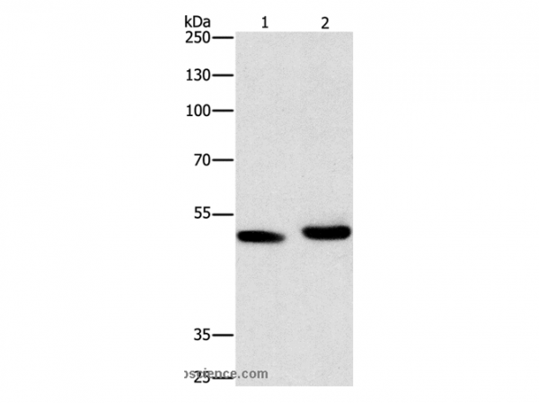 Anti-ATG4A
