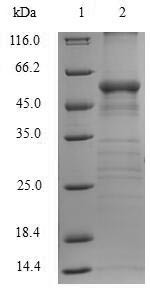 Arginase-1 (ARG1), human, recombinant