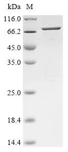 Transient receptor potential cation channel subfamily M member 1 (TRPM1), partial, human, recombinan