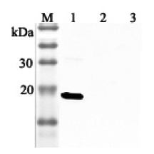 Anti-IL-33 (human)