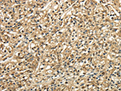 Anti-TSC22D1