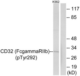 Anti-Phospho-FCGR2B (Tyr292)