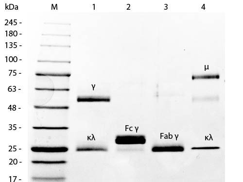 IgM, Mouse, Kappa myeloma protein, clone 10.C.11
