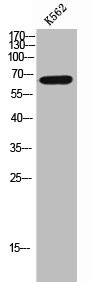 Anti-Phospho-PDLIM5 (Y251)