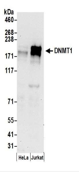 Anti-DNMT1