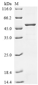 Tapasin (TAPBP), partial, human, recombinant