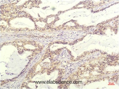 Anti-IL8, clone 13F8