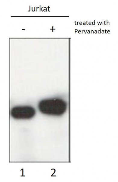 Anti-PLC gamma1, clone M156
