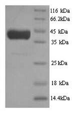 Cystathionine beta-synthase (CYS4), partial, Saccharomyces cerevisiae, recombinant