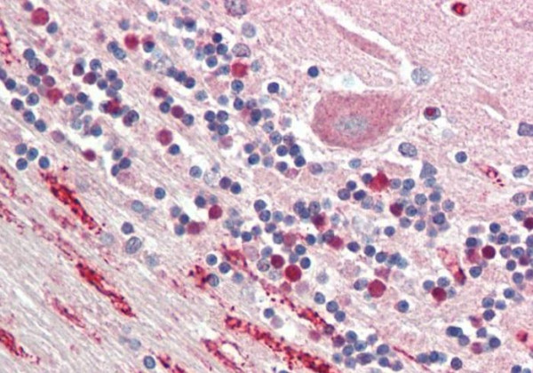Anti-NPTX1 / NP1