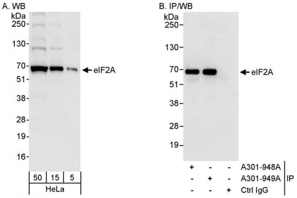 Anti-eIF2A