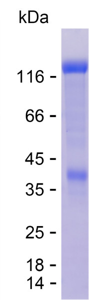 Recombinant Human COL6A1 Protein