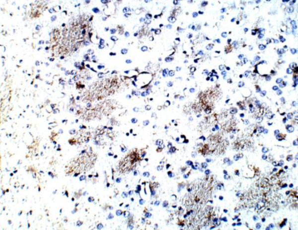 Anti-DRD2 / Dopamine D2 receptor