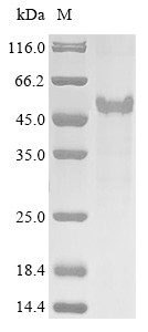 Laminin subunit gamma-2 (LAMC2), partial, human, recombinant