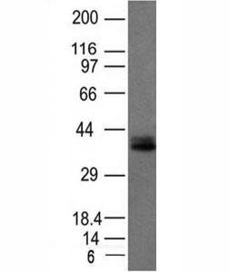 Anti-EpCAM, clone EGP40/1120