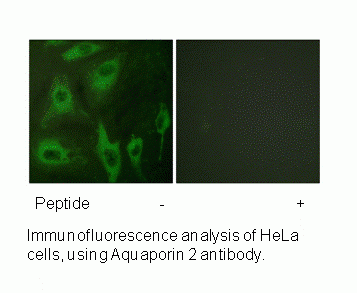 Anti-Aquaporin 2 (Ab-256)