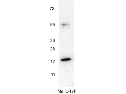 Anti-Interleukin-17F (IL-17F)