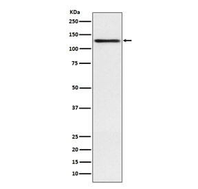 Anti-Involucrin, clone ABEA-9
