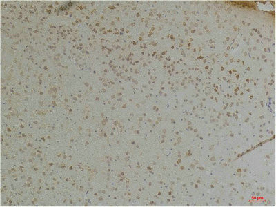 Anti-KCNIP1
