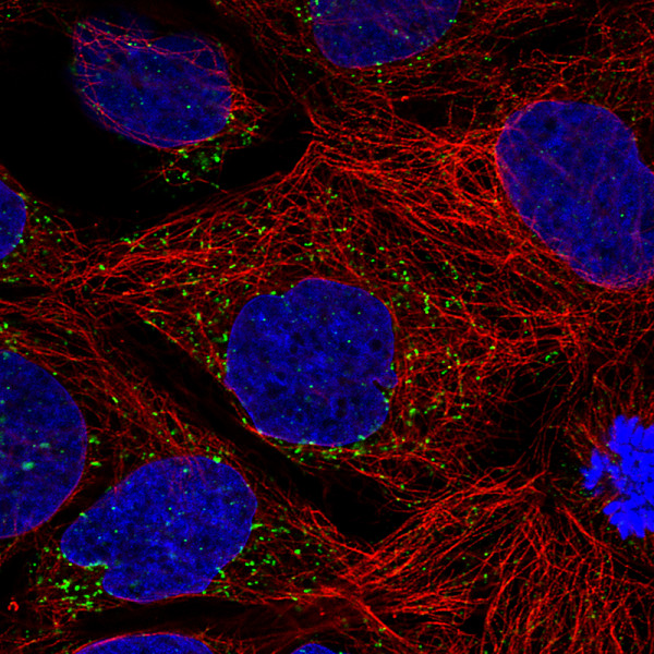 Anti-ACAA1, clone CL2662
