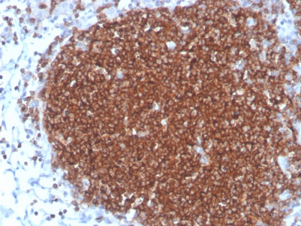 Anti-CD19 (B-Lymphocyte Marker), recombinant antibody, clone rCD19/4591