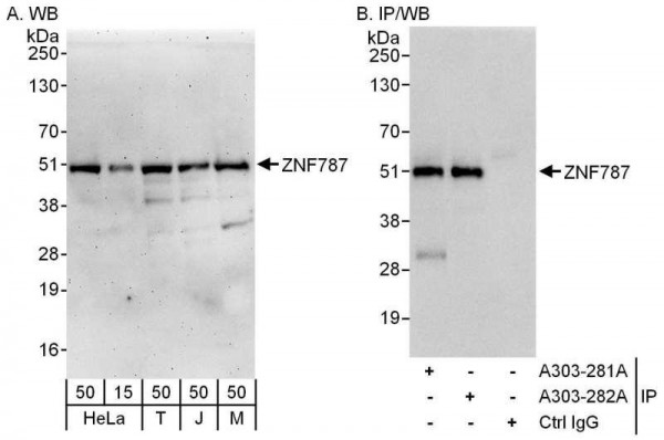 Anti-ZNF787