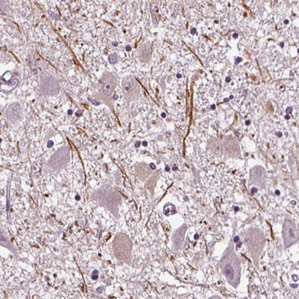 Anti-CNGA3