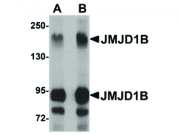 Anti-JMJD1B