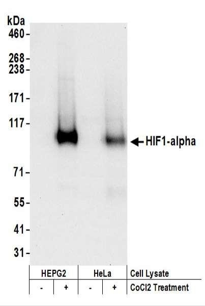 Anti-HIF1-alpha Recombinant Monoclonal