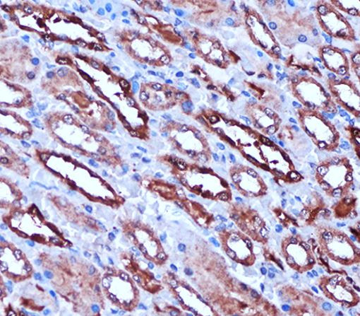Anti-CA2 / Carbonic Anhydrase 2