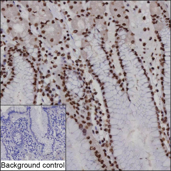 Anti-Ctcf