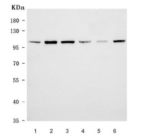 Anti-EAG1 / KCNH1