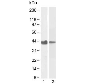 Anti-Smooth muscle alpha-actin