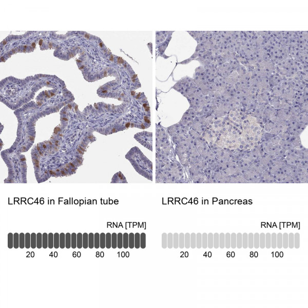 Anti-LRRC46