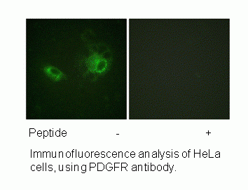 Anti-PDGFRB (Ab-1009)