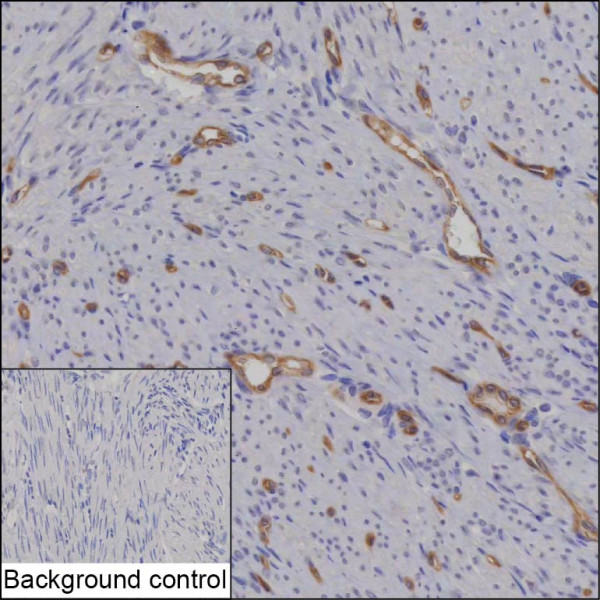 Anti-GNG11