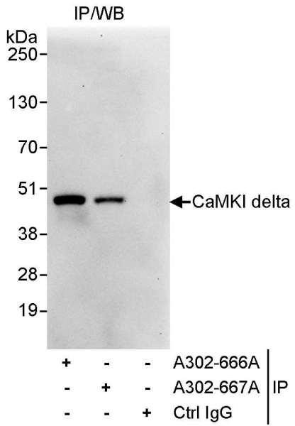 Anti-CaMKI delta