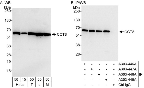 Anti-CCT8