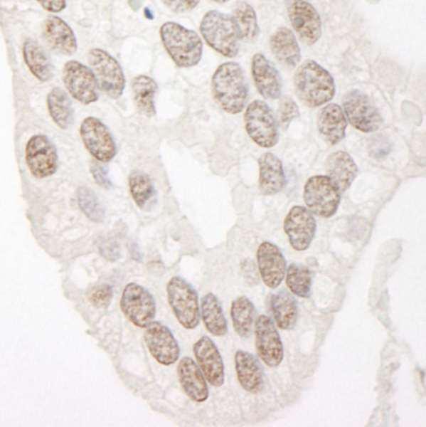 Anti-Cyclin L1 (IHC)