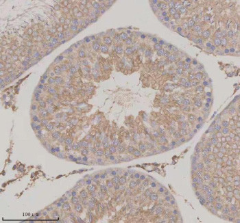 Anti-SERPINE2 / PN-1 / Protease nexin 1