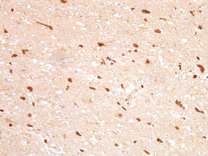 Anti-Isocitrate Dehydrogenase 1 [IDH1] (R132H Mutant) (human), clone AG-IHC132