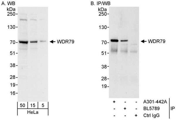 Anti-WDR79