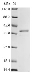 40S ribosomal protein S3 (RPS3), mouse, recombinant