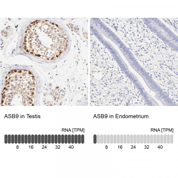 Anti-ASB9