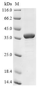 Chemokine-like receptor 1 (CMKLR1), partial, human, recombinant