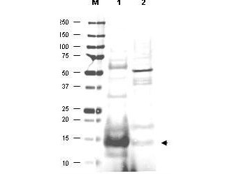 Anti-UBC13 (Ubiquitin-conjugating enzyme E2 N)